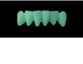 Ref.C16Facing : 1x  wax facing-bridge,  MEDIUM, Overlapping,(43-33), compatible with Ref.A16Lingual,(43-33), for long-term provisionals preparation
